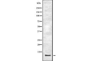Western blot analysis of CCL23 expression in HEK293 cells ,The lane on the left is treated with the antigen-specific peptide. (CCL23 抗体)