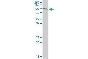 ACO1 MaxPab rabbit polyclonal antibody. (Aconitase 1 抗体  (AA 1-889))