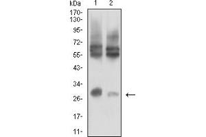 Western blot analysis using CD215 mouse mAb against LOVO (1) and HCT116 (2) cell lysate. (IL15RA 抗体  (AA 31-205))