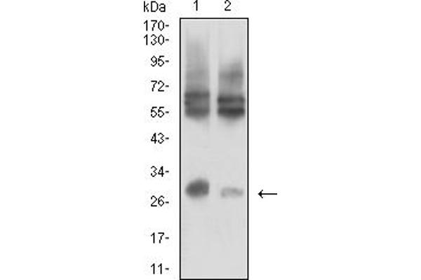IL15RA 抗体  (AA 31-205)