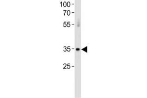 Western Blotting (WB) image for anti-Activating Transcription Factor 7 (ATF7) (AA 68-96) antibody (ABIN3028450)