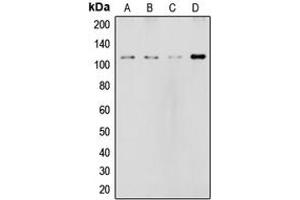 Western blot analysis of NOTCH2 expression in HeLa (A), MCF7 (B), rat liver (C), NIH3T3 (D) whole cell lysates. (NOTCH2 抗体  (Center))