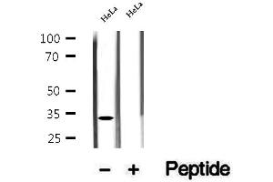 Western blot analysis of extracts of HeLa cells, using ASRGL1 antibody. (ASRGL1 抗体  (Internal Region))