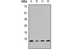 Western blot analysis of Calcitonin expression in MCF7 (A), SW480 (B), mouse lung (C), mouse liver (D) whole cell lysates. (Calcitonin 抗体  (C-Term))