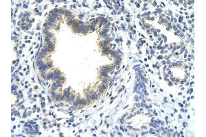 Rabbit Anti-KLHDC8A antibody         Paraffin Embedded Tissue:  Human Lung    cell Cellular Data:  bronchiole epithelium    Antibody Concentration:  4. (KLHDC8A 抗体  (C-Term))