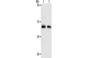 Gel: 8 % SDS-PAGE, Lysate: 40 μg, Lane 1-2: Human fetal kidney tissue, Human fetal lung tissue, Primary antibody: ABIN7128162(ACOT11 Antibody) at dilution 1/450, Secondary antibody: Goat anti rabbit IgG at 1/8000 dilution, Exposure time: 90 seconds (ACOT11 抗体)