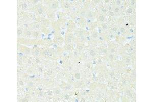 Immunohistochemistry of paraffin-embedded Rat liver using TRIM15 Polyclonal Antibody at dilution of 1:100 (40x lens). (TRIM15 抗体)