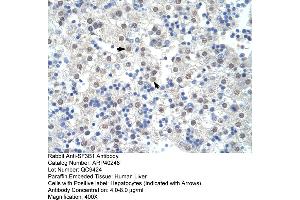 Rabbit Anti-SF3B1 Antibody  Paraffin Embedded Tissue: Human Liver Cellular Data: Hepatocytes Antibody Concentration: 4. (SF3B1 抗体  (Middle Region))