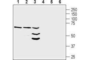 Western blot analysis of rat heart lysate (lanes 1 and 4), mouse heart membranes (lanes 2 and 5) and mouse brain lysate (lanes 3 and 6): - 1-3. (Neuregulin 1 抗体  (Extracellular, N-Term))