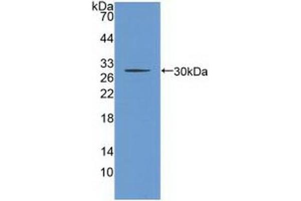CHRNB2 antibody  (AA 86-244)