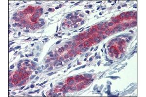 Human Breast: Formalin-Fixed, Paraffin-Embedded (FFPE) (YES1 抗体)