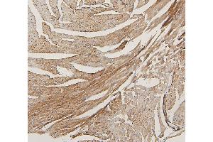 IHC analysis of LPP using anti-LPP antibody (ABIN7599606).