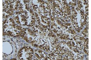 ABIN6268689 at 1/100 staining Mouse testis tissue by IHC-P. (HMOX2 抗体  (Internal Region))