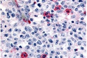 Anti-HRH4 / Histamine H4 Receptor antibody  ABIN1048966 IHC staining of human lymph node. (HRH4 抗体  (Cytoplasmic Domain))
