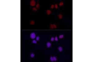 Immunofluorescence analysis of NCI-H460 using Brachyury Rabbit mAb (ABIN1682626, ABIN3019362, ABIN3019363 and ABIN7101757) at dilution of 1:100 (40x lens). (Scinderin 抗体)