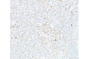Immunohistochemistry (IHC) image for anti-Runt-Related Transcription Factor 2 (RUNX2) (AA 300-350) antibody (ABIN7795798) (Recombinant RUNX2 抗体  (AA 300-350))