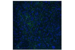 Immunofluorescence -- Dilution: 1. (HTR3E 抗体  (Middle Region))