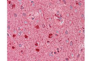 Anti-DCX / Doublecortin antibody IHC staining of human brain, cortex. (Doublecortin 抗体)