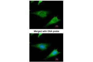 ICC/IF Image Immunofluorescence analysis of paraformaldehyde-fixed HeLa, using ribosomal protein S3a, antibody at 1:200 dilution. (RPS3A 抗体)