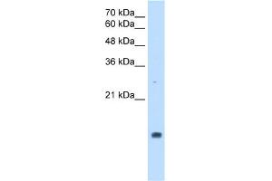 WB Suggested Anti-PPIA Antibody Titration:  2. (PPIA 抗体  (Middle Region))