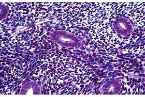 Human Uterus, Endometrium: Formalin-Fixed, Paraffin-Embedded (FFPE) (FANCA 抗体  (AA 1121-1170))