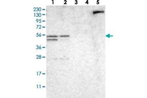 Western blot analysis of Lane 1: RT-4, Lane 2: U-251 MG, Lane 3: Human Plasma, Lane 4: Liver, Lane 5: Tonsil with NDRG3 polyclonal antibody  at 1:250-1:500 dilution. (NDRG3 抗体)