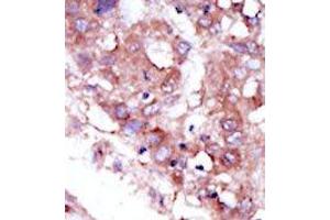 Image no. 1 for anti-serine/threonine Kinase 33 (STK33) (C-Term) antibody (ABIN359942) (STK33 抗体  (C-Term))
