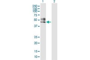 Western Blot analysis of RTN4R expression in transfected 293T cell line by RTN4R MaxPab polyclonal antibody. (RTN4R 抗体  (AA 1-473))