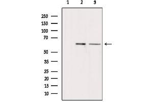 Arylsulfatase H 抗体