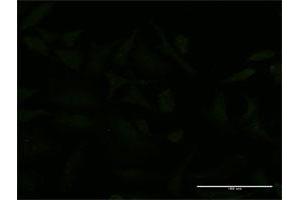 Immunofluorescence of monoclonal antibody to USP9X on HeLa cell. (USP9X 抗体  (AA 1-90))