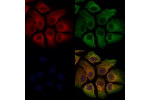ABIN7093796 and ABIN7097839 staining Hela cells by IF/ICC. (TREM2 抗体  (C-Term))