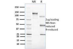 SDS-PAGE Analysis Purified CD1c Mouse Monoclonal Antibody (CD1C/1603). (CD1c 抗体)