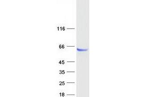 Western Blotting (WB) image for Protein Phosphatase 1J (PPM1J) protein (Myc-DYKDDDDK Tag) (ABIN2729814)