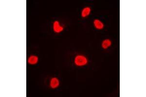 Immunofluorescent analysis of DNA-PKcs staining in MCF7 cells. (PRKDC 抗体  (C-Term))