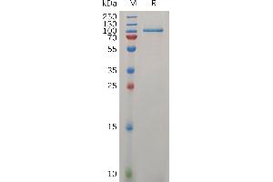 SDS-PAGE (SDS) image for Leucine-Rich Repeats and Immunoglobulin-Like Domains 1 (Lrig1) (AA 35-792) protein (His tag) (ABIN7490856)