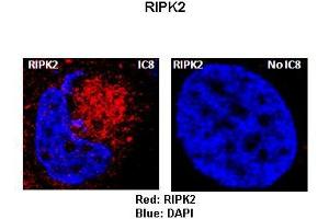 Sample Type :  Rat thyrocytes-FRTL-5   Primary Antibody Dilution :   1:100   Secondary Antibody :  Anti-rabbit-Texas Red   Secondary Antibody Dilution :   1:100   Color/Signal Descriptions :  Red: RIPK2 Blue: DAPI  Gene Name :  RIPK2  Submitted by :  Syed A Morshed, Mount Sinai School of Medicine and James J Peters VA Medical Center (RIPK2 抗体  (Middle Region))