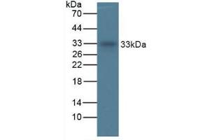 Mouse Detection antibody from the kit in WB with Positive Control: Sample Human Liver Tissue.