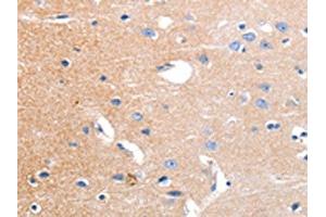 Immunohistochemistry (IHC) image for anti-Potassium Voltage-Gated Channel, Subfamily H (Eag-Related), Member 3 (Kcnh3) antibody (ABIN7191180)