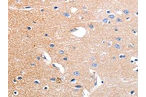 The image on the left is immunohistochemistry of paraffin-embedded Human brain tissue using ABIN7191180(KCNH3 Antibody) at dilution 1/12, on the right is treated with synthetic peptide. (KCNH3 抗体)