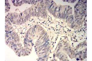 Immunohistochemistry (IHC) image for anti-Glutathione S-Transferase pi 1 (GSTP1) (AA 2-210) antibody (ABIN7193605)
