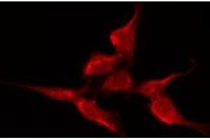 Immunofluorescence (fixed cells) (IF/ICC) image for anti-Calcium Channel, Voltage-Dependent, T Type, alpha 1H Subunit (CACNA1H) (Internal Region) antibody (ABIN6258628)