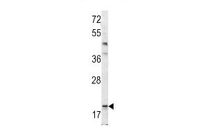 Western blot analysis of Bad BH3 Domain antibody (ABIN388118 and ABIN2846287) in mouse bladder tissue lysates (35 μg/lane). (BAD 抗体  (AA 92-127))