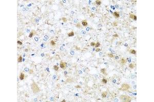 Immunohistochemistry (Paraffin-embedded Sections) (IHC (p)) image for anti-Zinc Finger and BTB Domain Containing 17 (ZBTB17) antibody (ABIN7264503)
