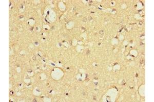 Immunohistochemistry of paraffin-embedded human brain tissue using ABIN7152265 at dilution of 1:100 (Exonuclease 1 抗体  (AA 301-600))