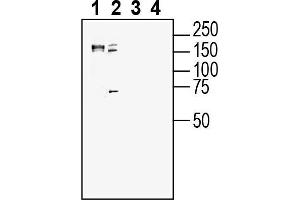 anti-Sortilin-Related VPS10 Domain Containing Receptor 2 (SORCS2) (AA 478-490), (Extracellular) antibody