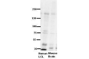 WB Suggested Anti-ZNF294 Antibody Titration:  5% Milk  ELISA Titer:  dilution: 1:500  Positive Control:  human LCL and mouse brains (RNF160 抗体  (N-Term))