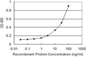 Detection limit for recombinant GST tagged NELL2 is 0. (NELL2 抗体  (AA 301-400))