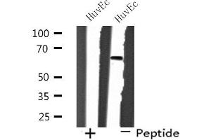 Western blot analysis of extracts from HuvEc cells, using SH2B2 antibody. (SH2B2 抗体  (N-Term))