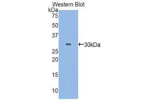 Western Blotting (WB) image for anti-Myosin Heavy Chain 3, Skeletal Muscle, Embryonic (MYH3) (AA 1403-1645) antibody (ABIN1859927)