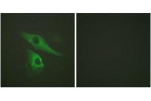 Immunofluorescence analysis of HeLa cells, using Keratin 8 (Ab-73) Antibody. (KRT8 抗体  (AA 41-90))